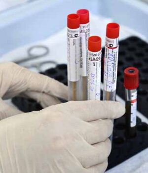 0-1 За добу в Нововолинську - один новий випадок коронавірусу