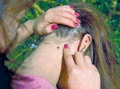 Зареєстровано випадок захворювання на Лайм бореліоз від укусу кліща Зареєстровано випадок захворювання на Лайм бореліоз від укусу кліща