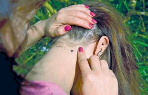 Зареєстровано випадок захворювання на Лайм бореліоз від укусу кліща Зареєстровано випадок захворювання на Лайм бореліоз від укусу кліща