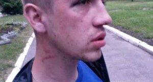 У нововолинській міліції катують людей, а прокуратура хоче “зам’яти” справу? У нововолинській міліції катують людей