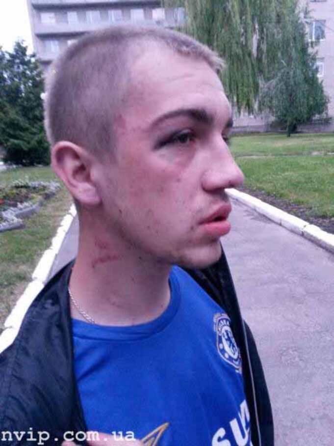 У нововолинській міліції катують людей, а прокуратура хоче “зам’яти” справу? У нововолинській міліції катують людей
