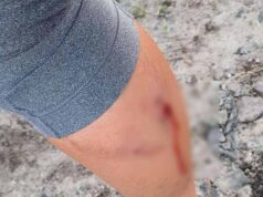 Відому нововолинську фітнес-тренерку покусала вівчарка Відому нововолинську фітнес-тренерку покусала вівчарка