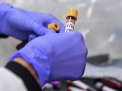 За добу у Нововолинську виявили 7 нових випадків коронавірусу За добу у Нововолинську виявили 7 нових випадків коронавірусу