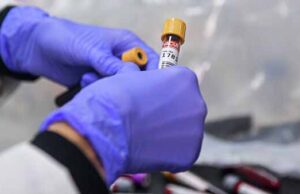 За добу у Нововолинську виявили 7 нових випадків коронавірусу За добу у Нововолинську виявили 7 нових випадків коронавірусу