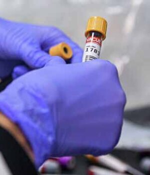 За добу у Нововолинську виявили 7 нових випадків коронавірусу