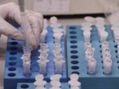 У жителя Луцького району експрес-тест показав позитивний результат на коронавірус У жителя Луцького району експрес-тест показав позитивний результат на коронавірус