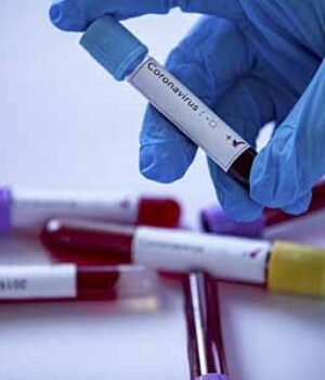 1f77307-koronavirus485 У Нововолинську виявили два нових випадки COVID-19