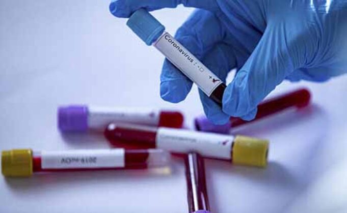 У Нововолинську виявили два нових випадки COVID-19 У Нововолинську виявили два нових випадки COVID-19