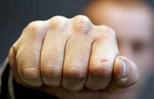 Депутат Климович каже, що затримував п’яного водія, а його звинуватили в побитті! Депутат Климович каже