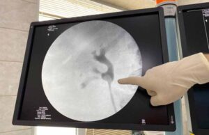 Урологи КНП «НЦМЛ» доводять свою майстерність використовуючи передові технології та сучасне ендоскопічне обладнання Урологи КНП «НЦМЛ» доводять свою майстерність використовуючи передові технології та сучасне ендоскопічне обладнання