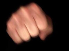 Чоловікові посеред дня розтрощили носа Чоловікові посеред дня розтрощили носа