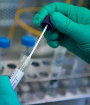 За добу у Нововолинську підтвердили 17 нових випадів COVID-19