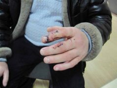 Судили рецидивіста, який покусав дільничного Судили рецидивіста