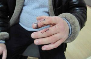 Судили рецидивіста, який покусав дільничного Судили рецидивіста