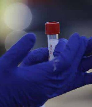 602x338_cmsv2_c3ebbec4-796f-56a0-8e8b-52aa324cc37a-4612246_1 За добу у Нововолинську підтвердили аж 19 нових випадків коронавірусу