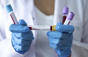 У Нововолинську від COVID-19 померла одна людина У Нововолинську від COVID-19 померла одна людина