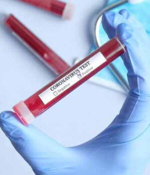 7ab6d96-virus01_1 У Нововолинську - 4 нових випадки коронавірусу