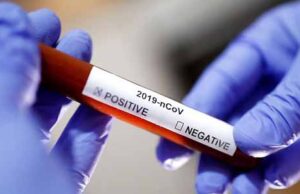 За добу в Україні виявили 638 випадів COVID-19, з них на Волині – 9 За добу в Україні виявили 638 випадів COVID-19