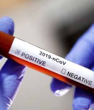 За добу в Україні виявили 638 випадів COVID-19