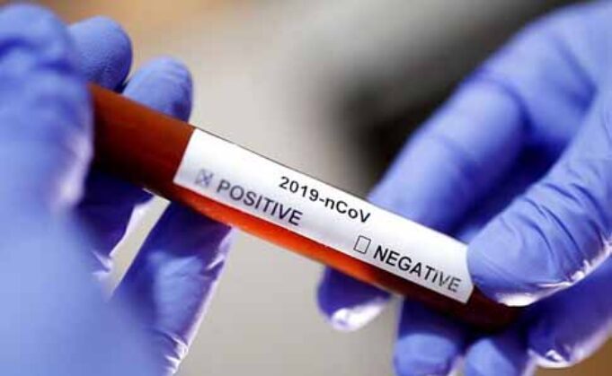 За добу в Україні виявили 638 випадів COVID-19, з них на Волині – 9 За добу в Україні виявили 638 випадів COVID-19