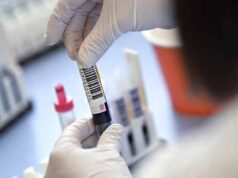 У Нововолинську – жодного нового випадку коронавірусної хвороби У Нововолинську - жодного нового випадку коронавірусної хвороби