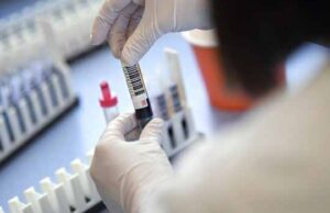 За добу у Нововолинську виявили аж 16 нових випадків COVID-19 За добу у Нововолинську виявили аж 16 нових випадків COVID-19