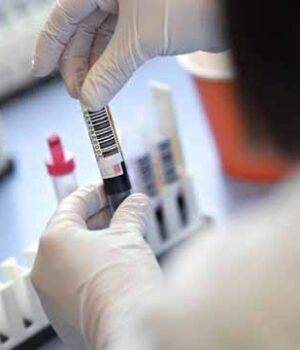 c159bb354c08de4a3b8c56dd13cc64c0 За добу у Нововолинську виявили аж 16 нових випадків COVID-19