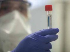 У нововолинця експрес-тест показав позитивний результат на коронавірус У нововолинця експрес-тест показав позитивний результат на коронавірус