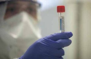 У нововолинця експрес-тест показав позитивний результат на коронавірус У нововолинця експрес-тест показав позитивний результат на коронавірус