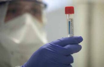 У нововолинця експрес-тест показав позитивний результат на коронавірус У нововолинця експрес-тест показав позитивний результат на коронавірус