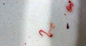 Черв’яки у питній воді міста Нововолинська!!! (відео) Черв'яки у питній воді міста Нововолинська!!! (відео)