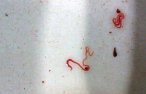 Черв’яки у питній воді міста Нововолинська!!! (відео) Черв'яки у питній воді міста Нововолинська!!! (відео)