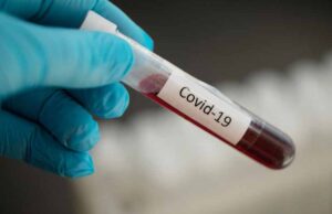 У Нововолинську за добу виявили 22 нових випадки захворювання на COVID-19 У Нововолинську за добу виявили 22 нових випадки захворювання на COVID-19