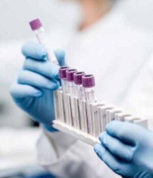 covid-19-840x480-1 За добу у Нововолинську виявили аж 8 нових випадків коронавірусу