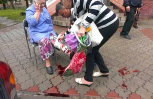 Бродячі собаки покусали бабусю (ФОТО 18+) Бродячі собаки покусали бабусю (ФОТО 18+)