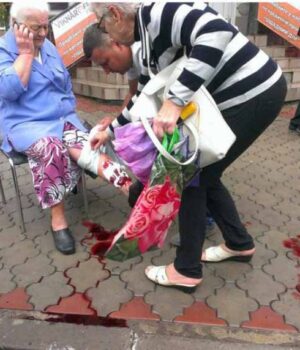 dogsnovik Бродячі собаки покусали бабусю (ФОТО 18+)