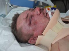 Чоловік, якого побили у Нововолинську, помер в реанімації Чоловік
