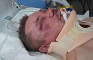 Чоловік, якого побили у Нововолинську, помер в реанімації Чоловік