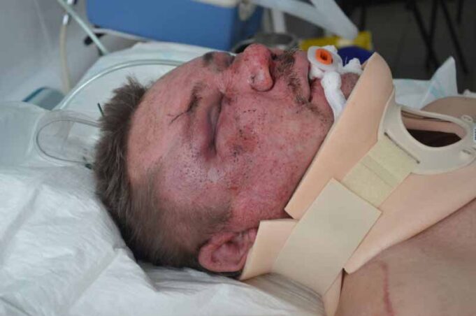 Чоловік, якого побили у Нововолинську, помер в реанімації Чоловік