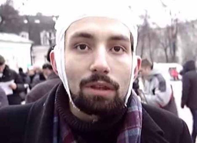 На нас напали без жодного приводу і били всіх підряд!!! Інтерв’ю НВІП На нас напали без жодного приводу і били всіх підряд!!! Інтерв'ю НВІП
