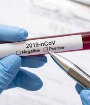 fc97ff3483c42e96f4bc49cb399d9a7add26a9d2_3 За добу у Нововолинську - 4 нових випадків COVID-19