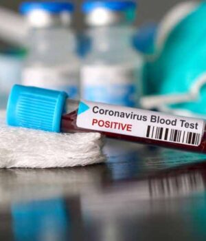 У Нововолинську - 20 нових випадків захворювання на Covid-19. Одна людина померла