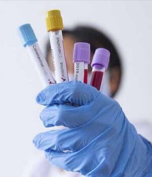 На двох підприємствах Нововолинська тривають спалахи COVID-19