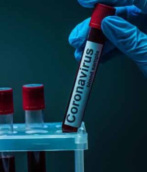 newsbel.by-13.07.2020-6nom2e35w6tk7refgooouhuuiengpwhm У Нововолинську підтвердили ще 10 випадків коронавірусу