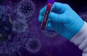 У Нововолинську – 7 нових випадків COVID-19 У Нововолинську - 7 нових випадків COVID-19