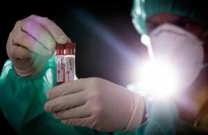 У Нововолинську ще 9 людей захворіли на Covid-19 У Нововолинську ще 9 людей захворіли на Covid-19