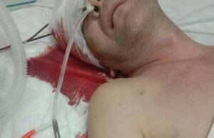 Шахтар з Волині потрапив у реанімацію: необхідні кошти на лікування! Шахтар з Волині потрапив у реанімацію: необхідні кошти на лікування!