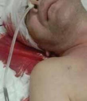 Шахтар з Волині потрапив у реанімацію: необхідні кошти на лікування!