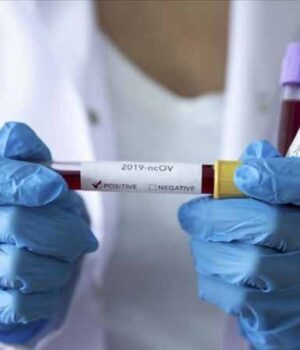 У Нововолинську виявили 16 нових випадків коронавірусу