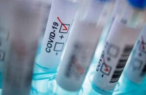 У Нововолинську – 17 нових випадків інфікування COVID-19 У Нововолинську - 17 нових випадків інфікування COVID-19